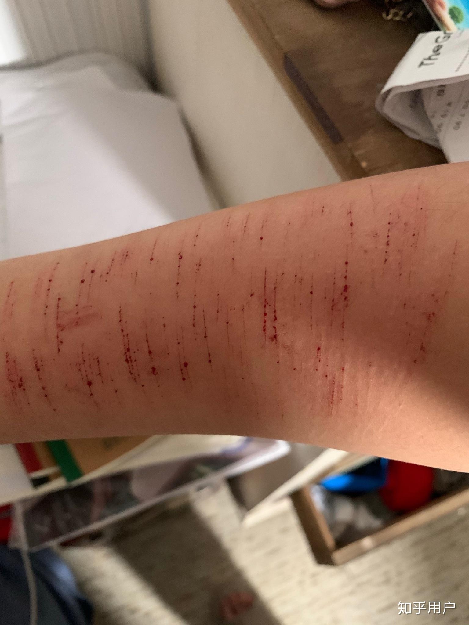 自残属于什么心理