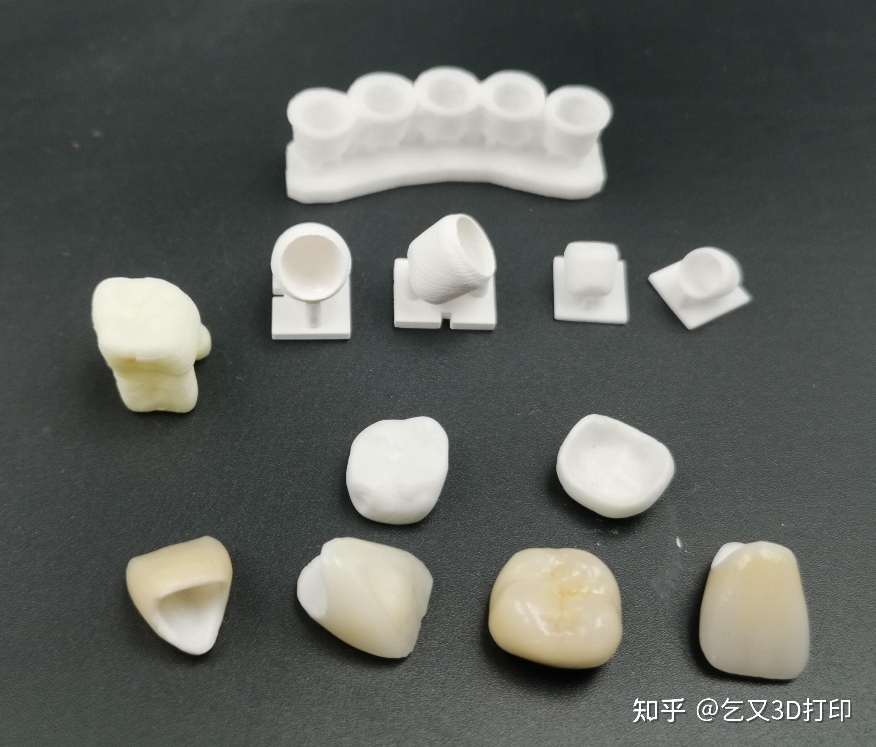 陶瓷3D打印应用——义齿&修复 - 知乎