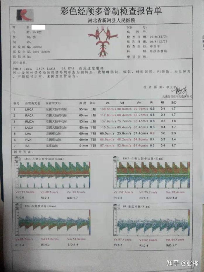 医理求真眩晕症