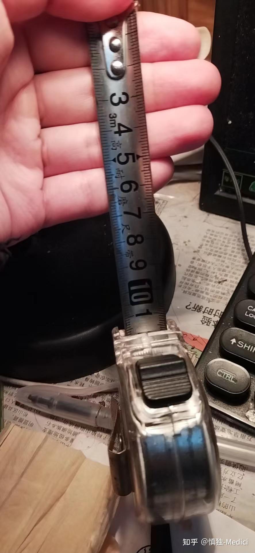 正畸导致颞下颌关节紊乱的原因+张口多少宽度算正常 - 知乎