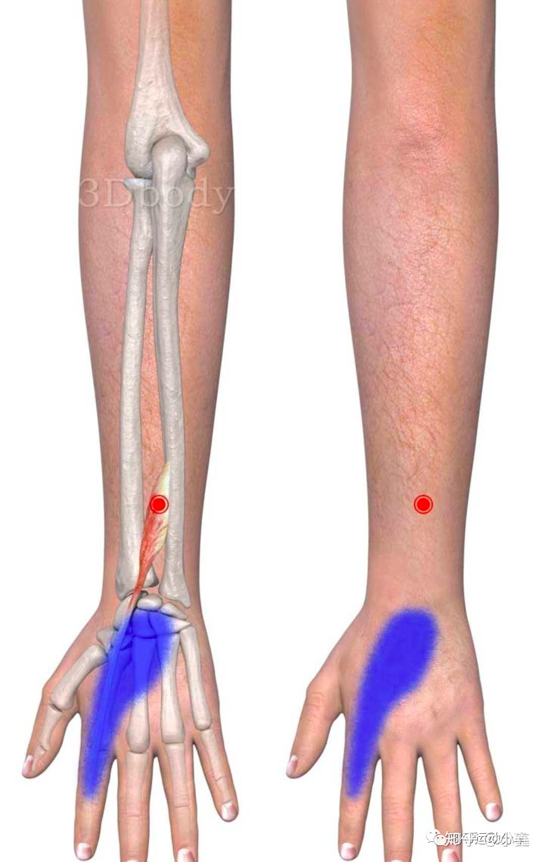 指伸肌和示指伸肌触发点疗法