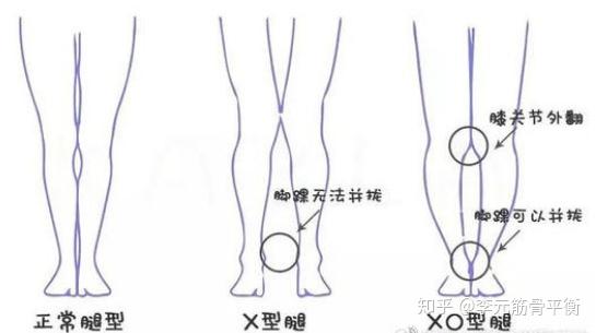 孩子膝盖内侧骨头突出图片