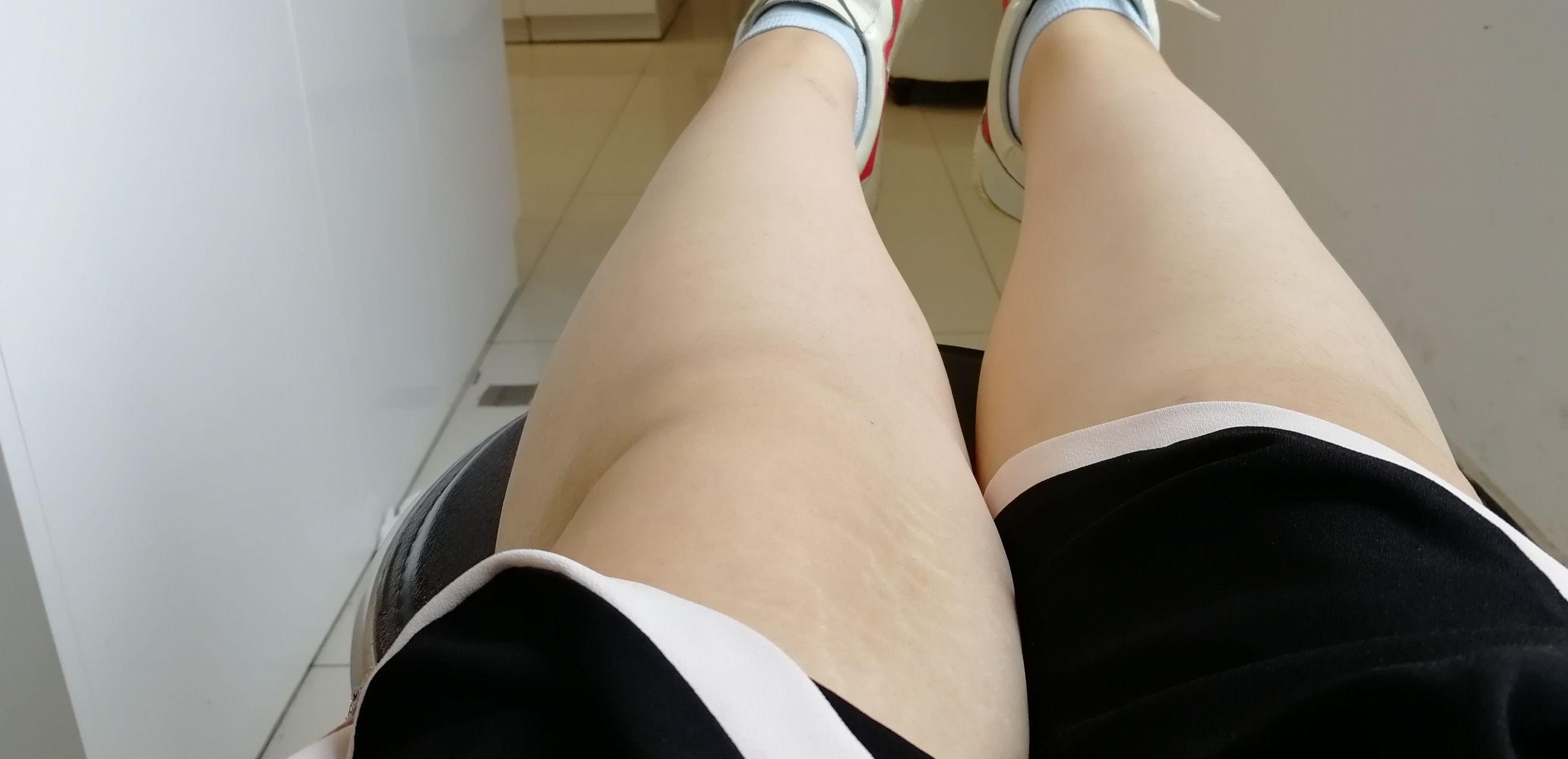 女生腿粗是怎样一种体验