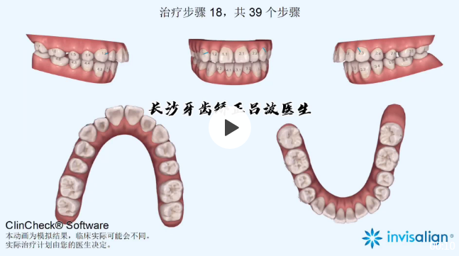 v2-95391a8f2c4e6f08f65cc5f9a8608b68_1440w.jpg?source=172ae18b