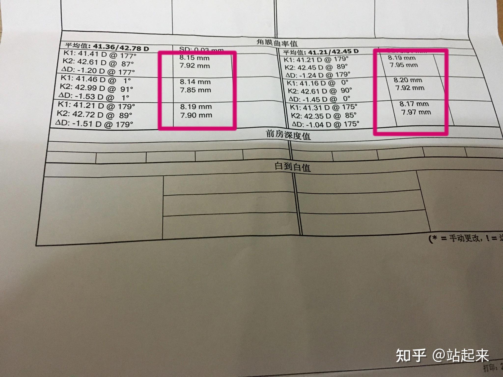 请问各位知友们,这个单子下的角膜曲率要怎么换算成基弧? 