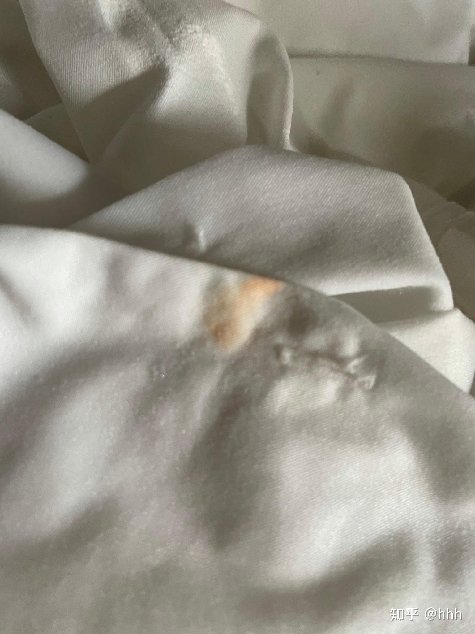 姐妹们 衣服上有污渍怎么去除啊啊啊? - 知乎