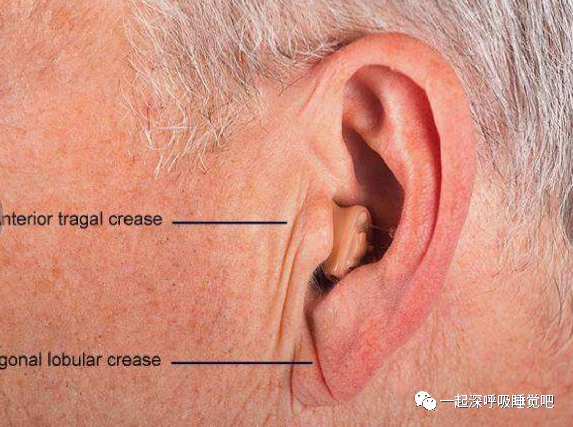 注意你的耳朵可能会出卖你的心噢