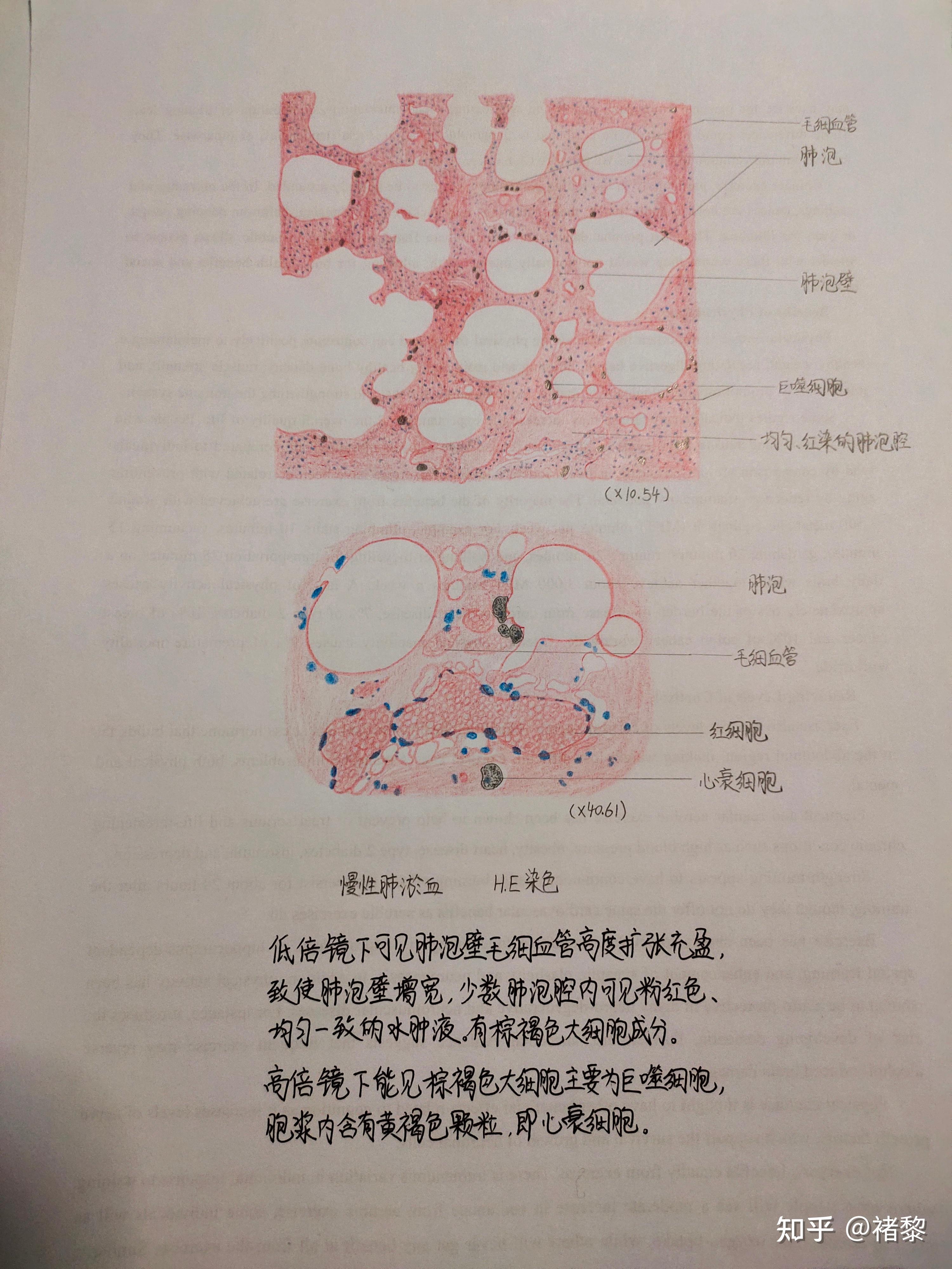 癌巢手绘图图片