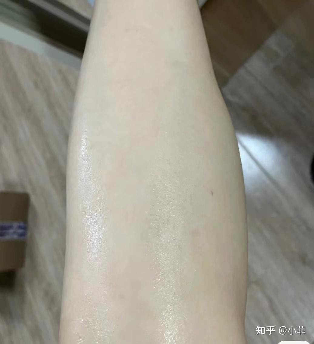 女生体毛旺盛，想脱毛算是过度容貌焦虑吗？脱毛膏过敏，有没有靠谱对皮肤好一点的脱毛仪？Ulike新品体验分享
