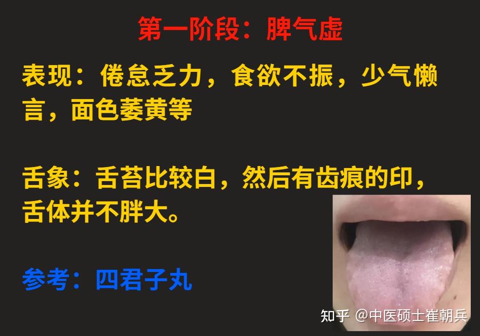 脾气虚、脾阳虚,由轻到重,看看自己的脾虚在哪个阶段?12个阶段的脾虚一次讲明白 - 知乎