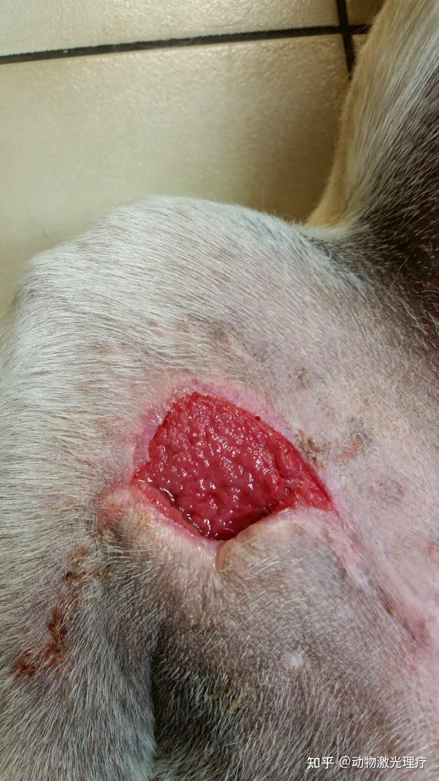 愈合状况良好:激光治疗2次后,新生的良好的肉芽组织:切除坏死组织后