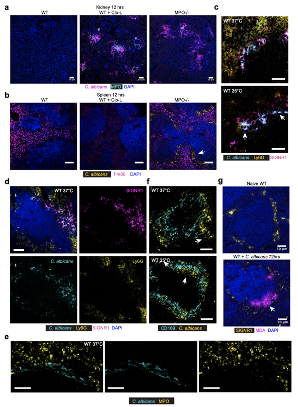 Nature子刊丨脾脏巨噬细胞捕获微生物通过 T 细胞死亡依赖性中性粒细胞寿命缩短引发脓毒症 - 知乎