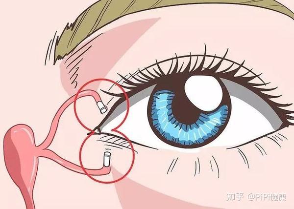 为什么眼睛总流眼泪?可能和这5种疾病有关,别大意! - 知乎