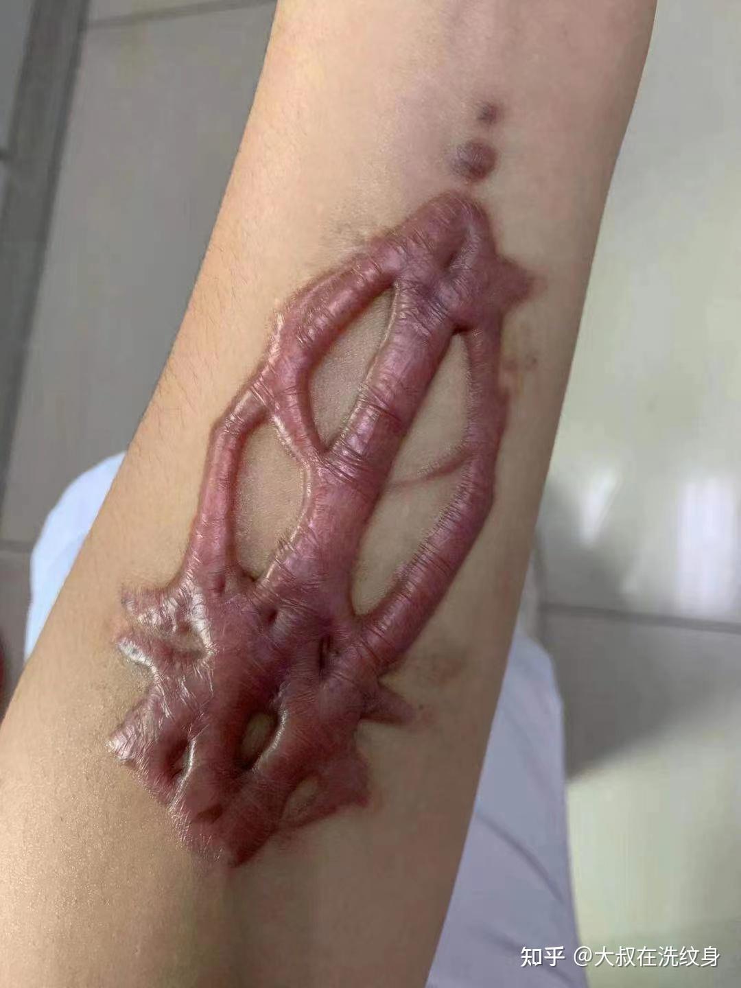 手背上纹了个面积很大的纹身可以洗吗