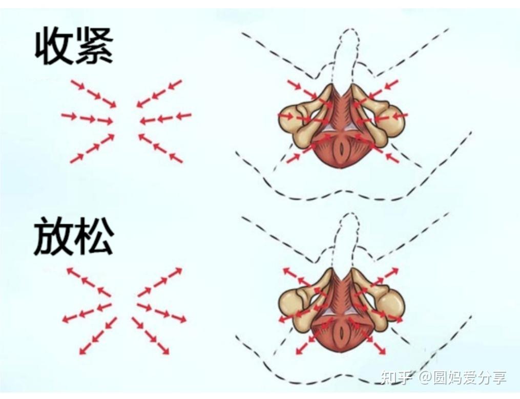 男性锻炼盆底肌有用吗