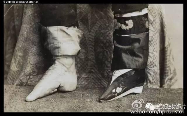 对于缠足,大家脑海里的画面一