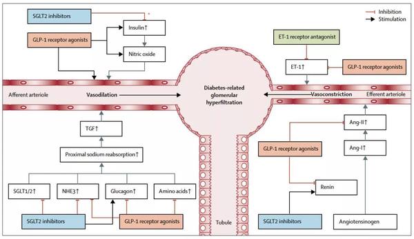 SGLT-2抑制剂：不仅让你「安心」，还「安肾」 - 知乎