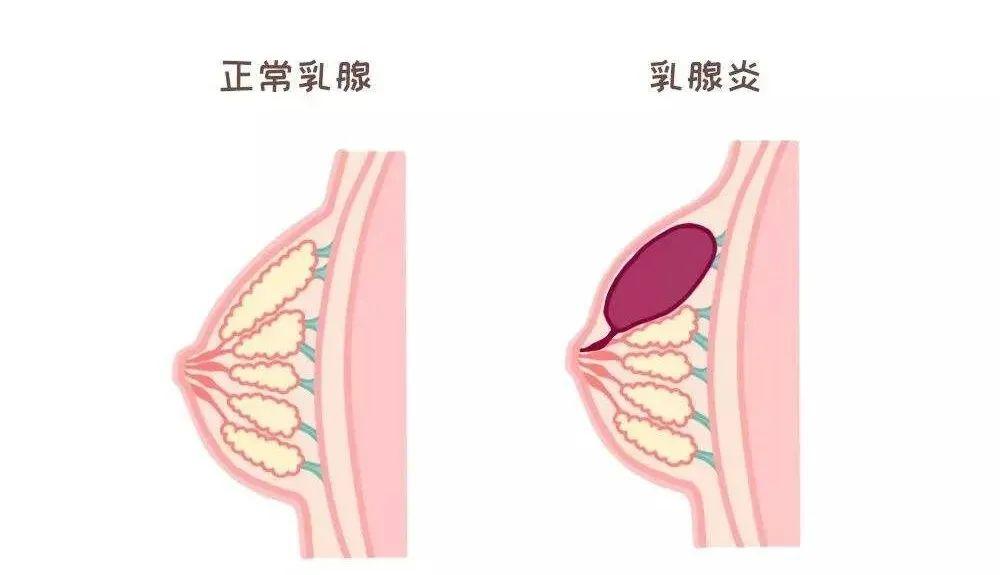 奶乳房长什么样子图片