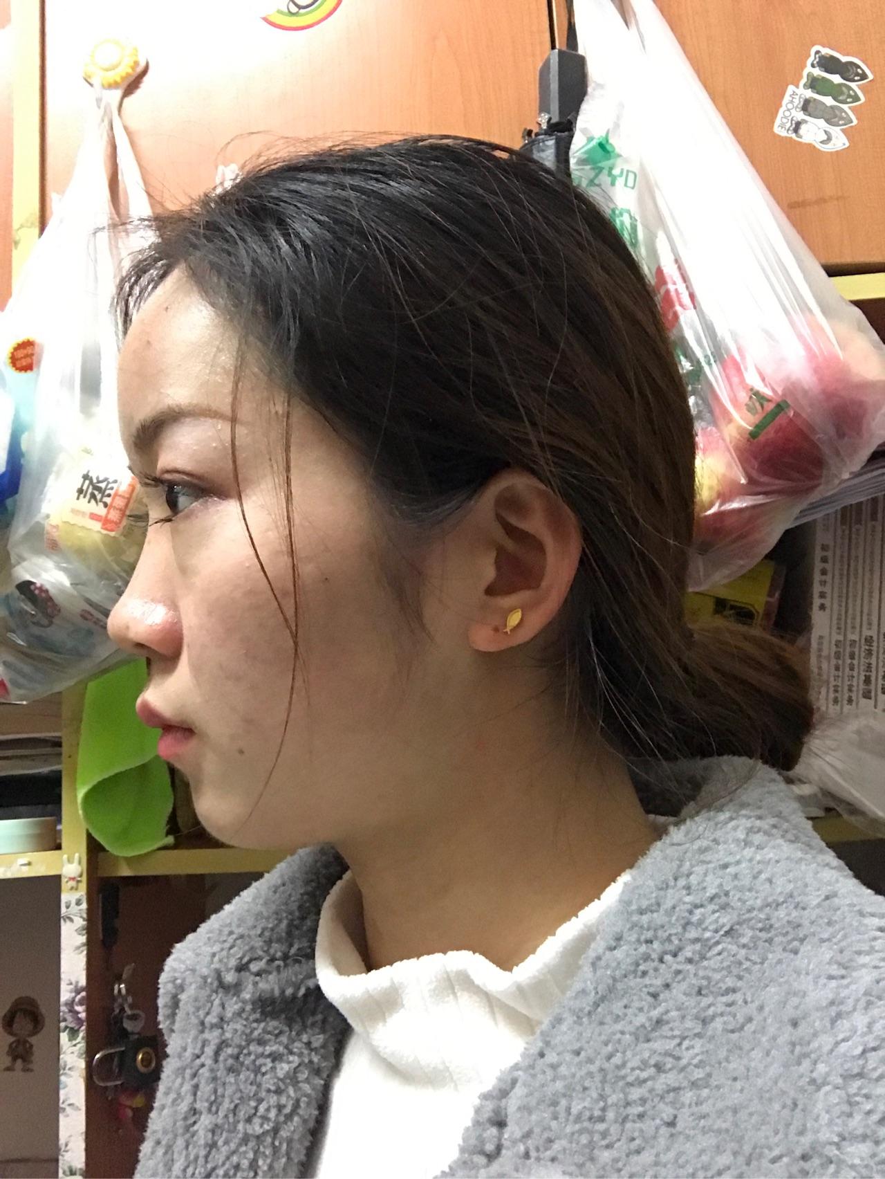 感觉自己的侧脸不好看应该怎么改变