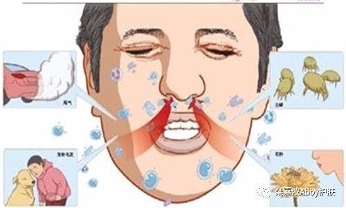 什么是过敏源?过敏源有哪几种? - 知乎