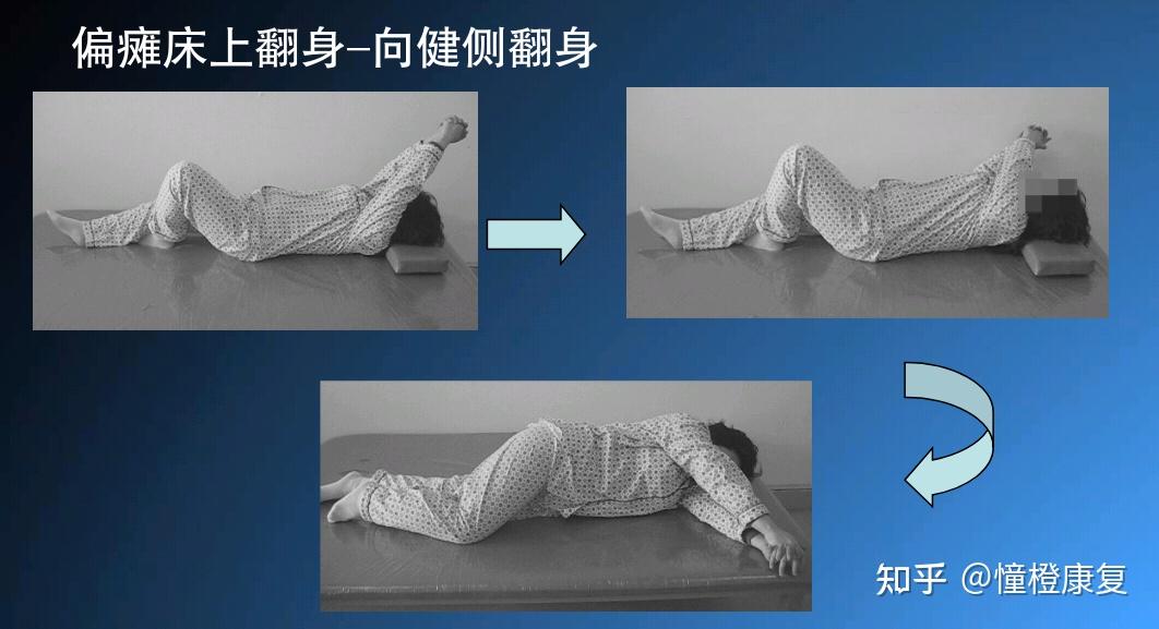 作业治疗之偏瘫患者床上活动 - 知乎