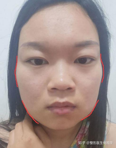 国字脸女,我这种脸型怎么自救? - 知乎