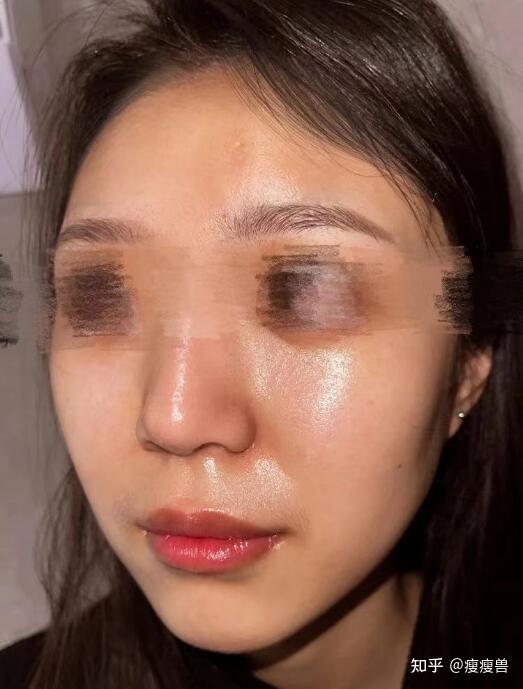 皮肤的好坏对颜值的改变有多大? - 知乎