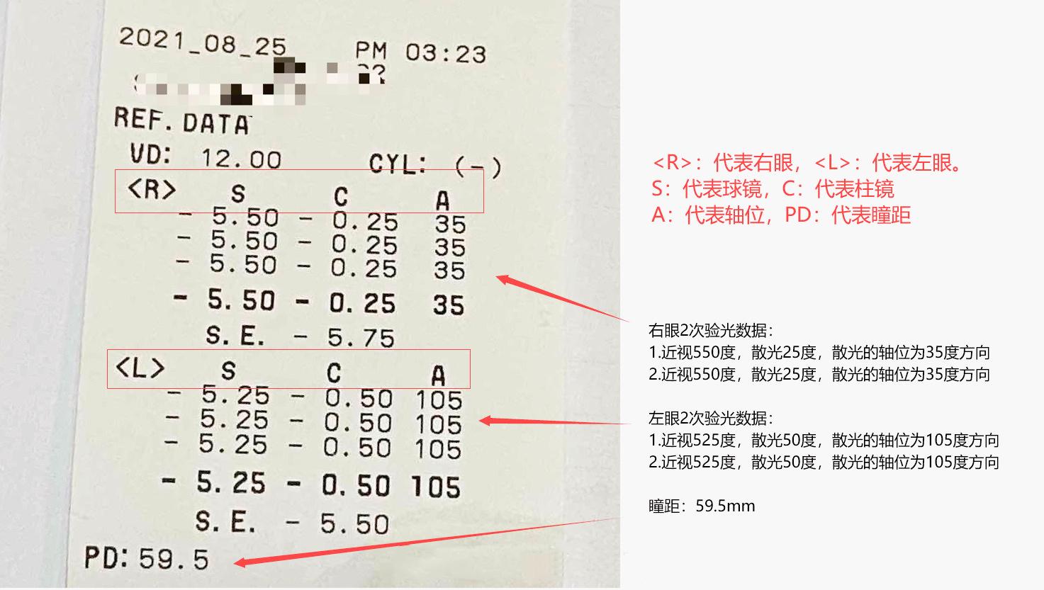 电脑验光仪准确吗