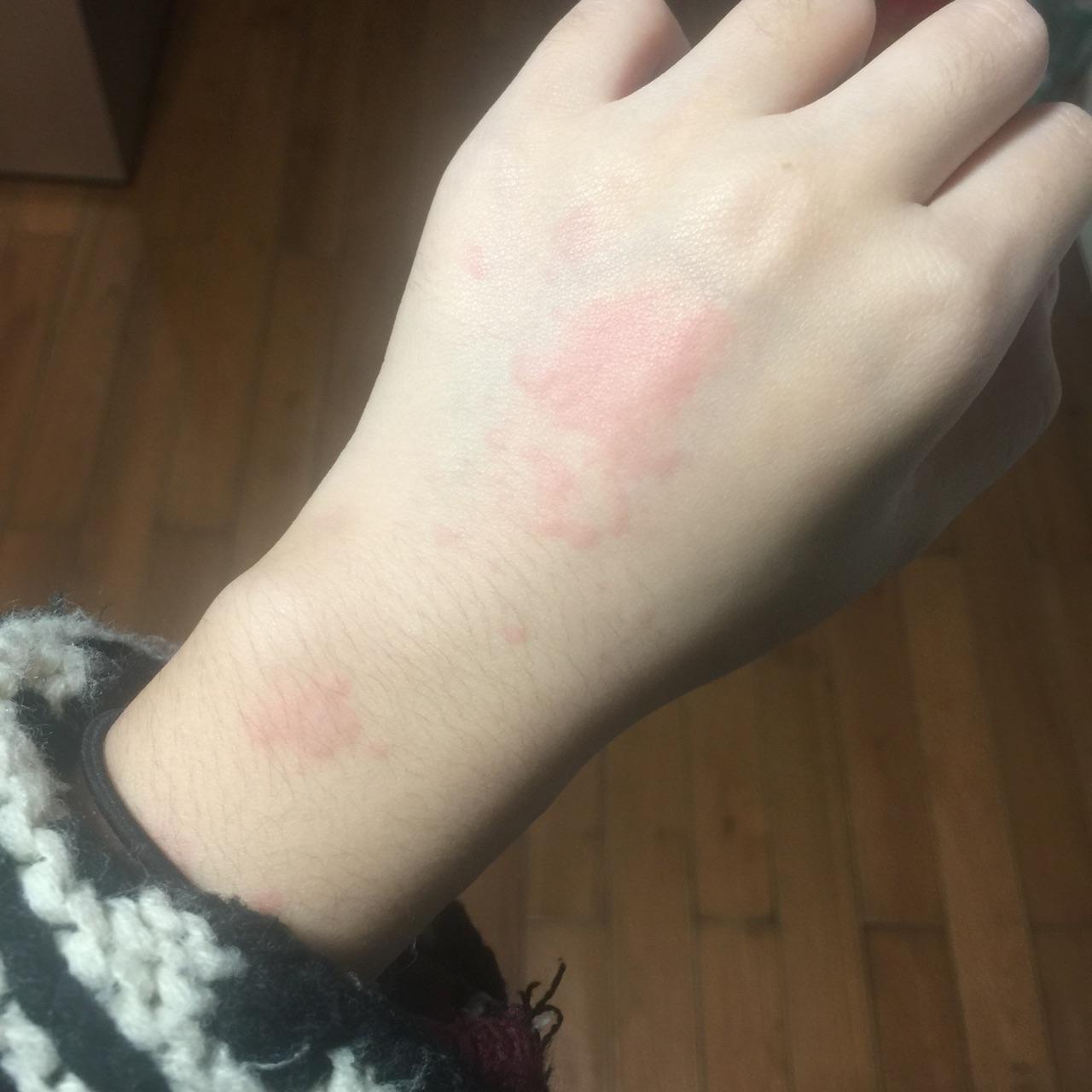对动物毛过敏是一种怎样的体验?