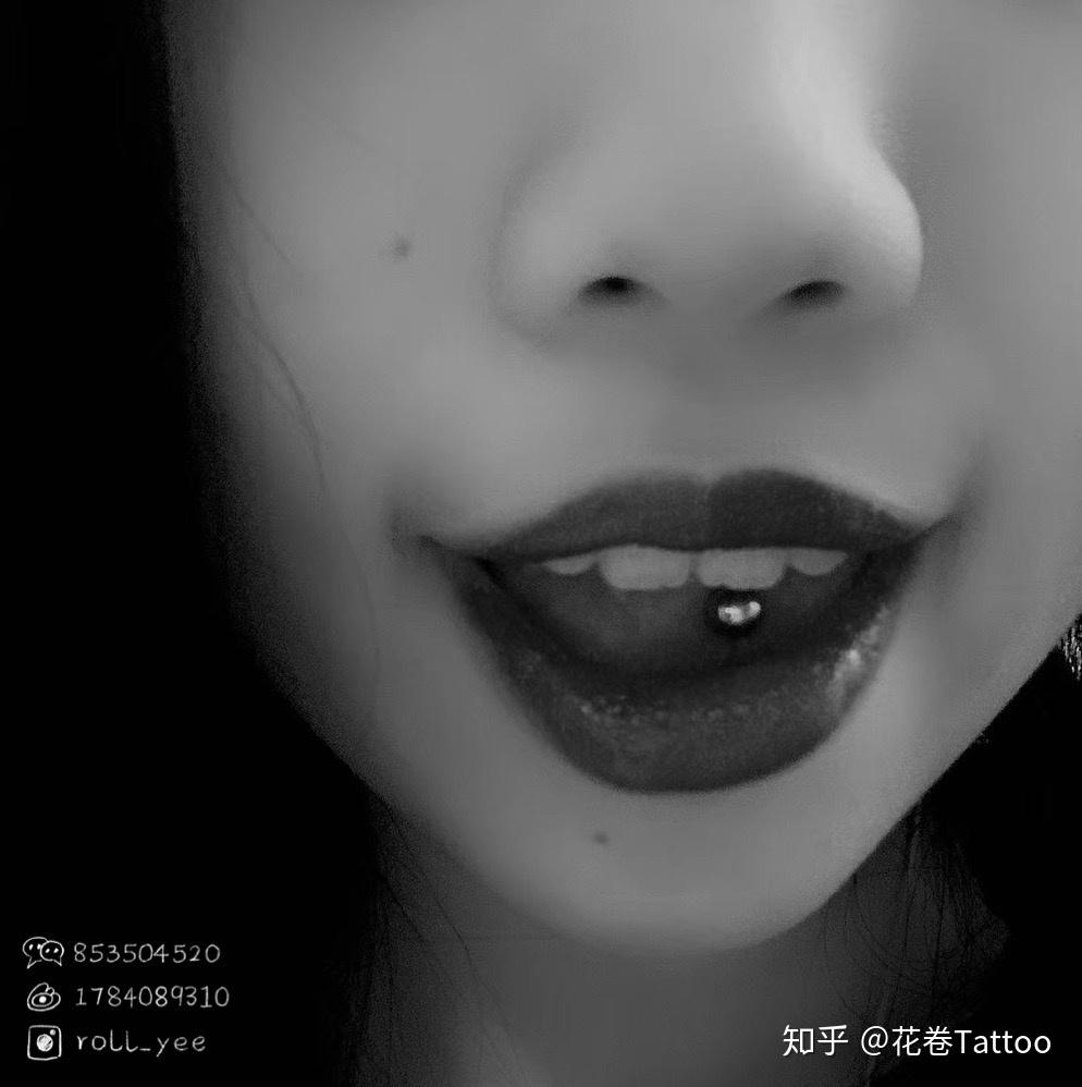 人体穿刺 || 穿孔的恢复时间周期 - 知乎
