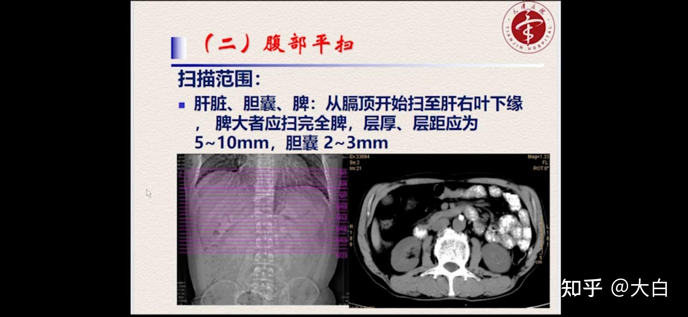 下腹部ct扫描范围图片