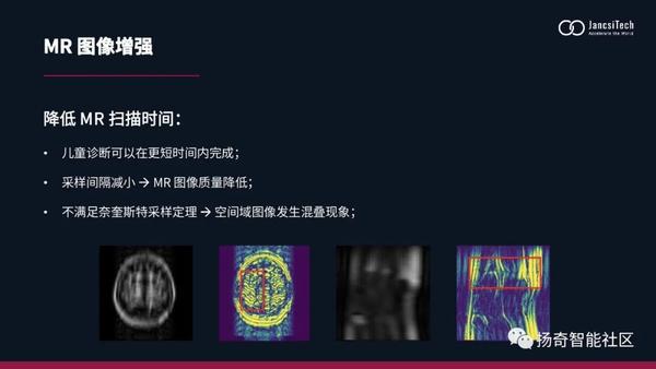 扬奇智能社区|医学影像增强算法 - 知乎
