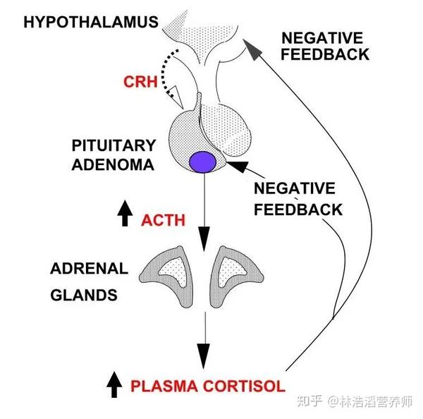 鉴别诊断|你是库欣综合征吗? - 知乎