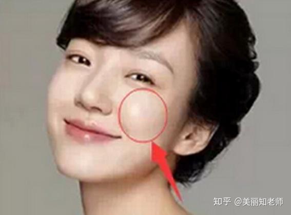 苹果肌干瘪,没有笑容力量?