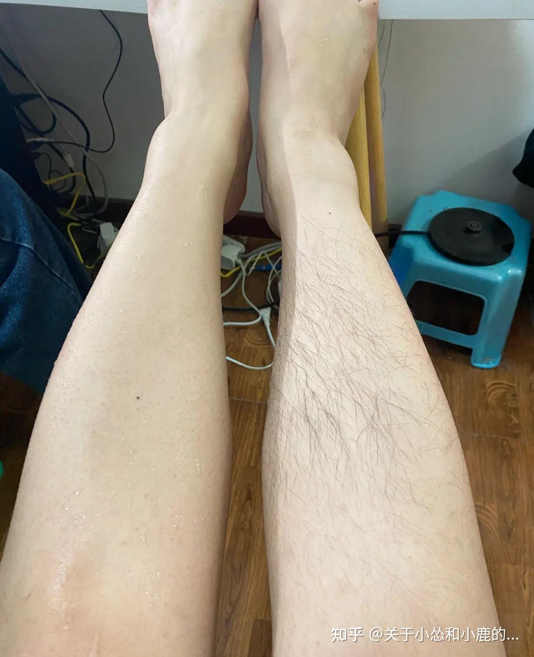 女生汗毛重是怎样的一种体验?