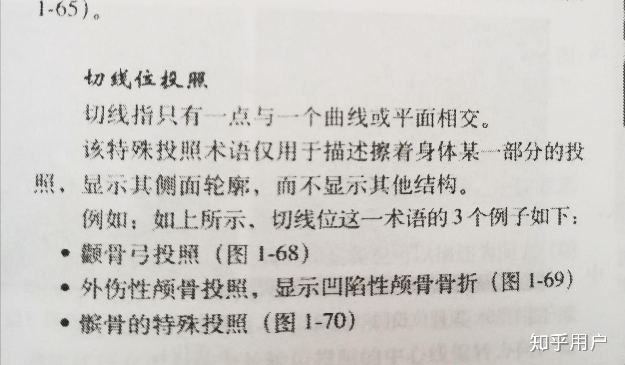 影像学上的切线位是啥意思啊