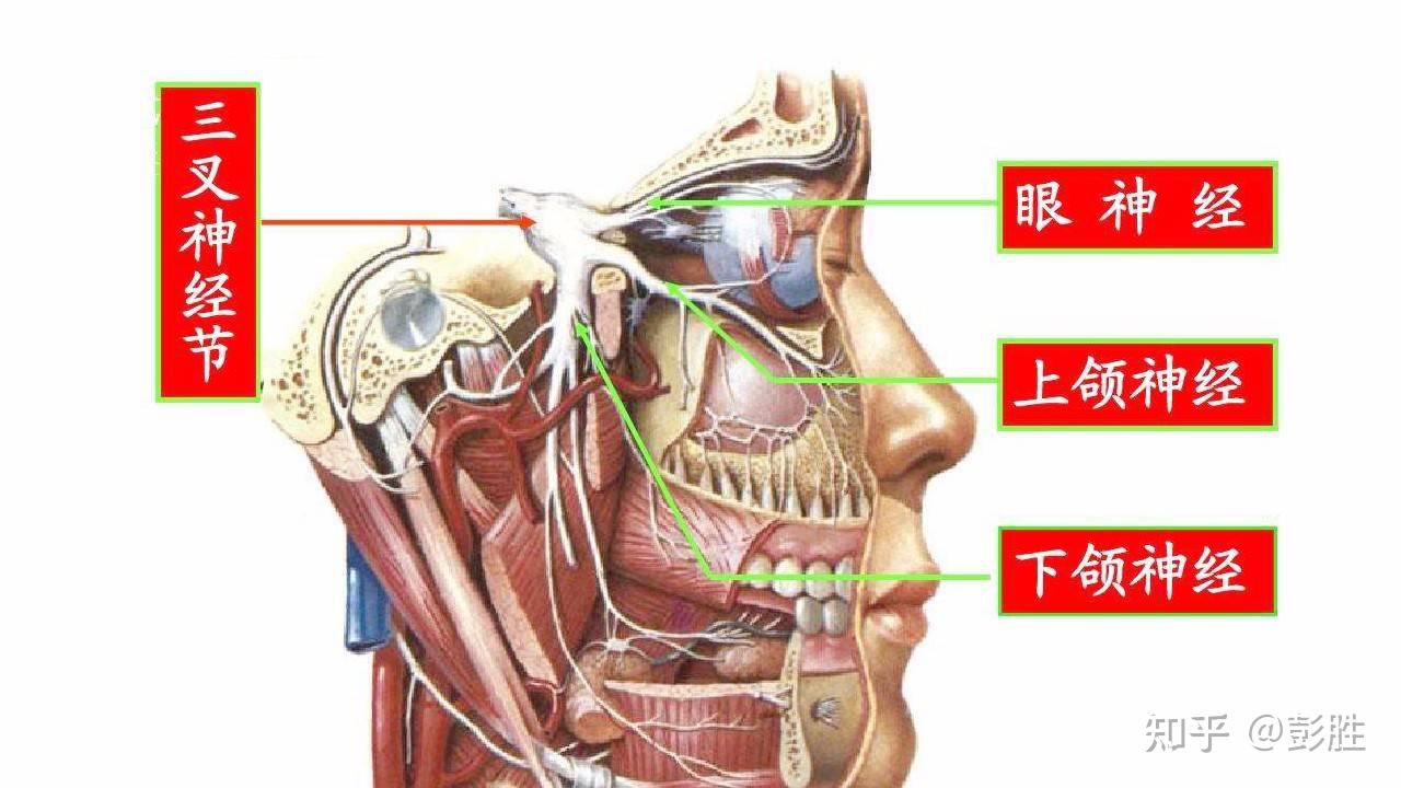 三叉神经痛发病原因有哪些? - 知乎