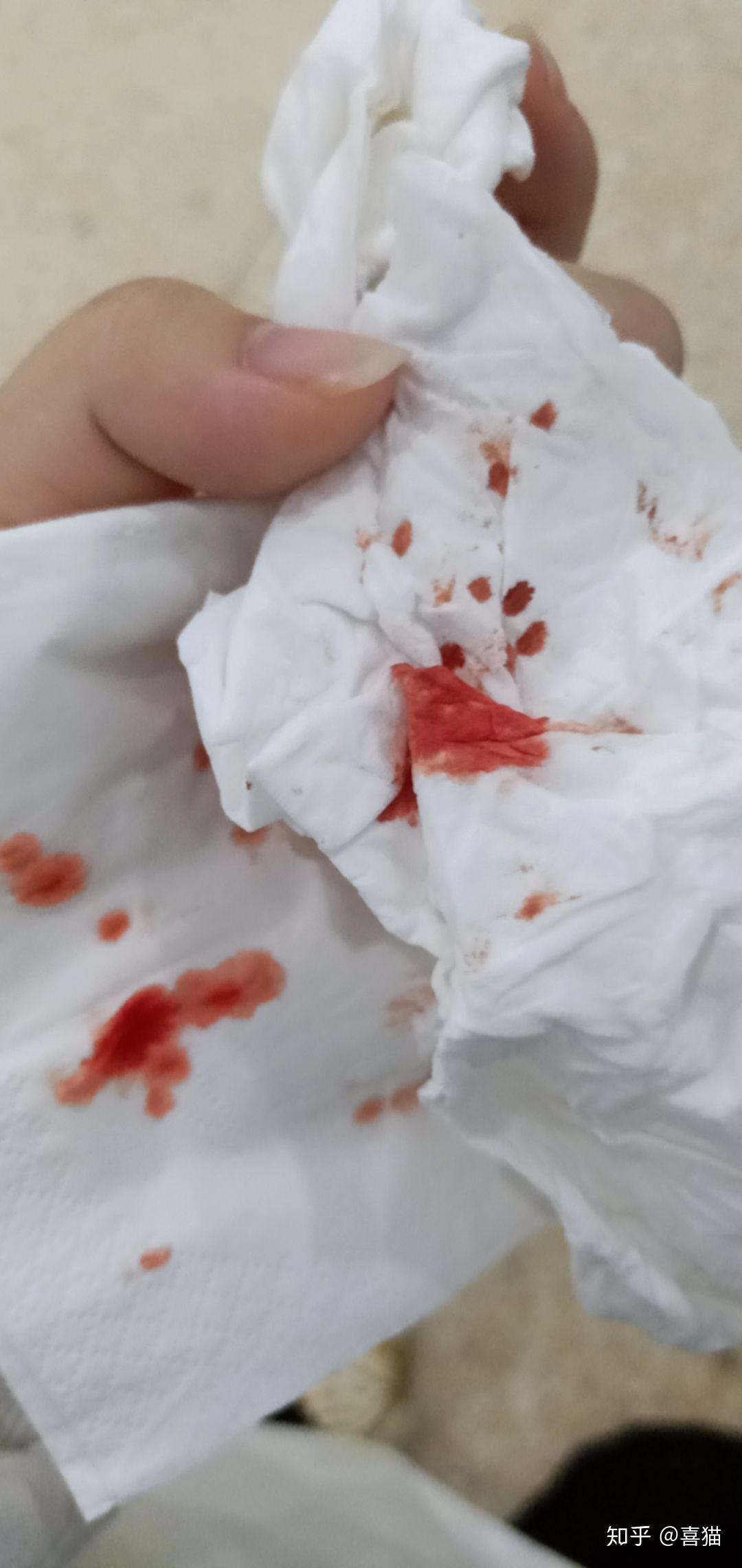 摔倒后嘴唇磕烂了好了以后肿起一个包了怎么办