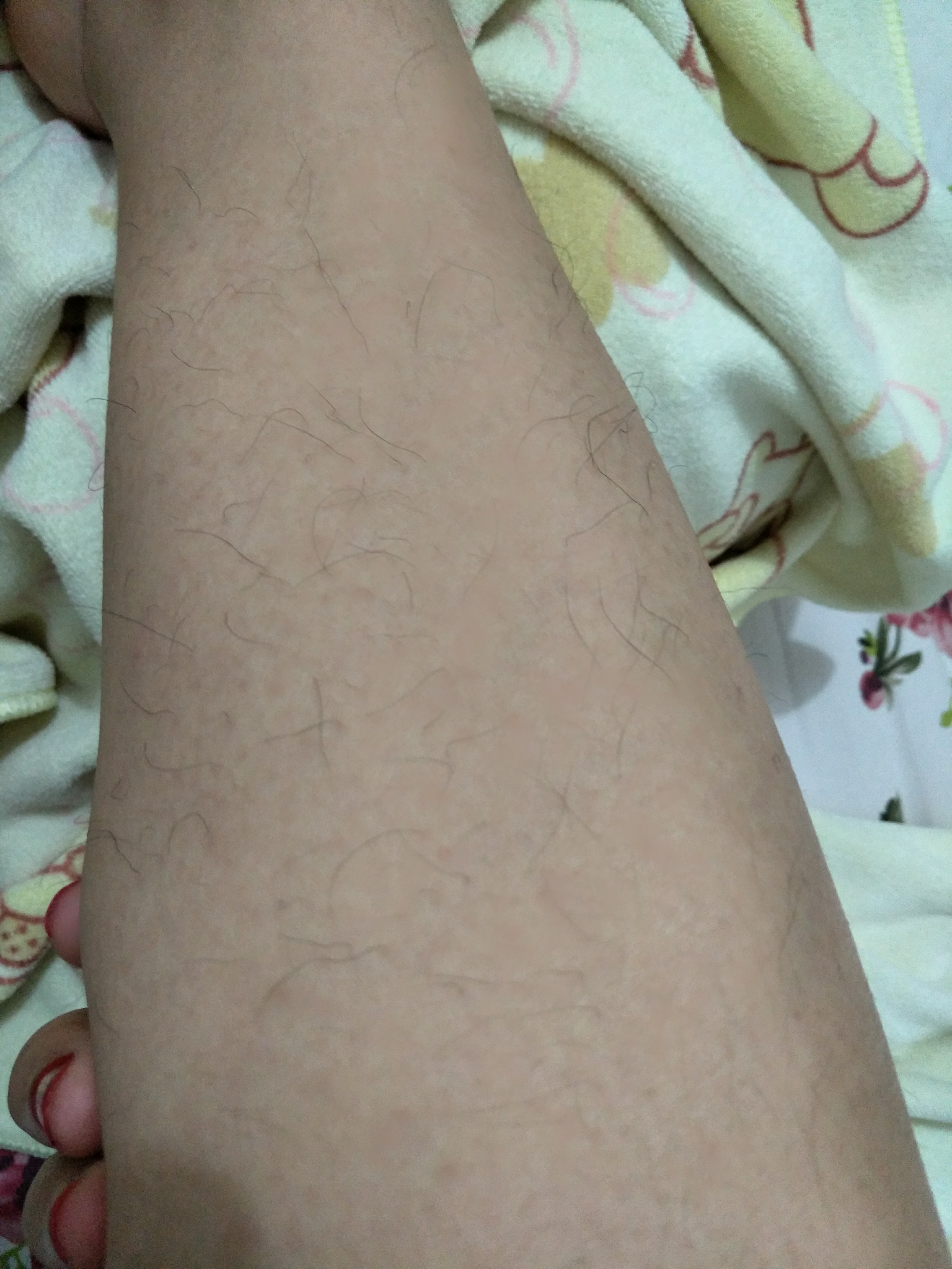 女生腿毛旺盛是怎样的人生体验