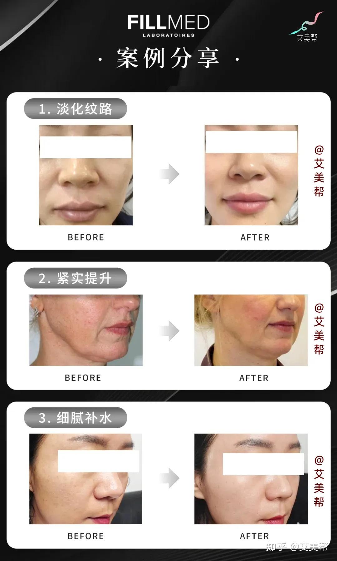 银盒菲洛嘉135ha科普,菲洛嘉和菲欧曼的关系,银盒与红盒的区别