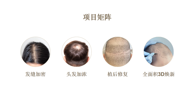 女生发缝稀疏露白|女性可以纹发吗? - 知乎