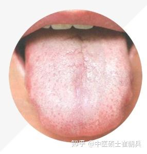 史上最全舌诊图谱!【珍藏版】 - 知乎
