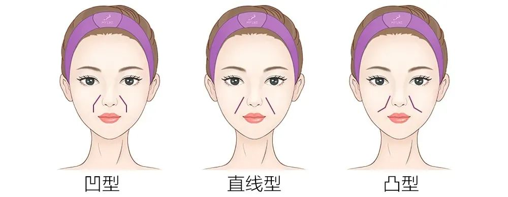 法令纹越来越深用什么办法解决好