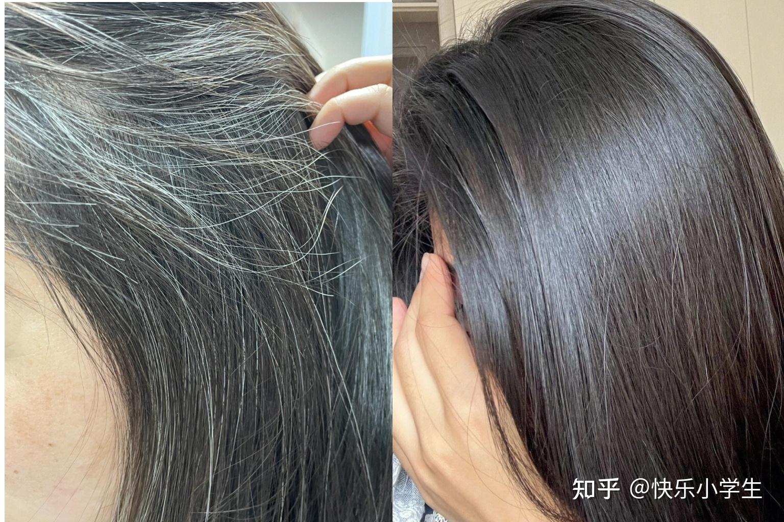 白发转黑5个月真实记录(自用分享) - 知乎