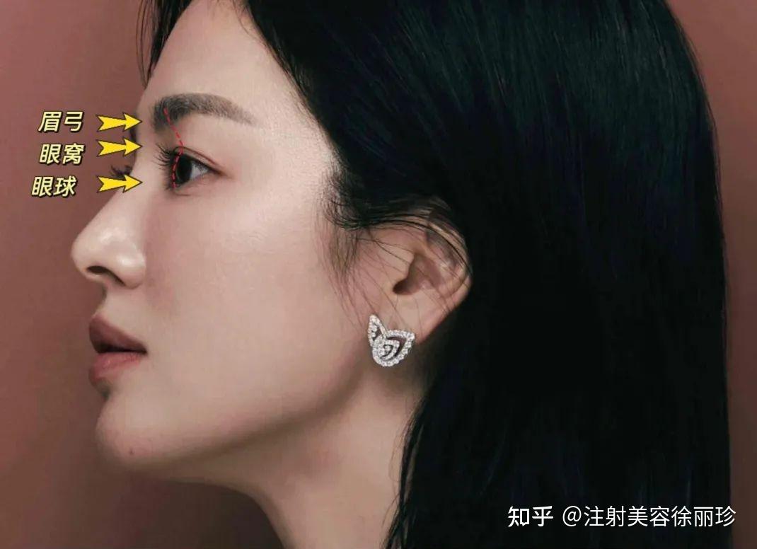眉弓的艺术,才是影响我们眉形和上面部折叠度的关键 - 知乎