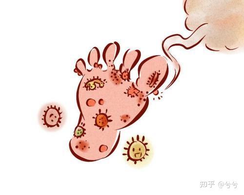 为什么夏天脚容易长水泡还很痒还要掉皮
