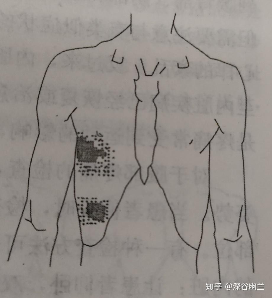 讀書筆記鎖骨下肌胸骨肌肋間肌和膈肌觸發點