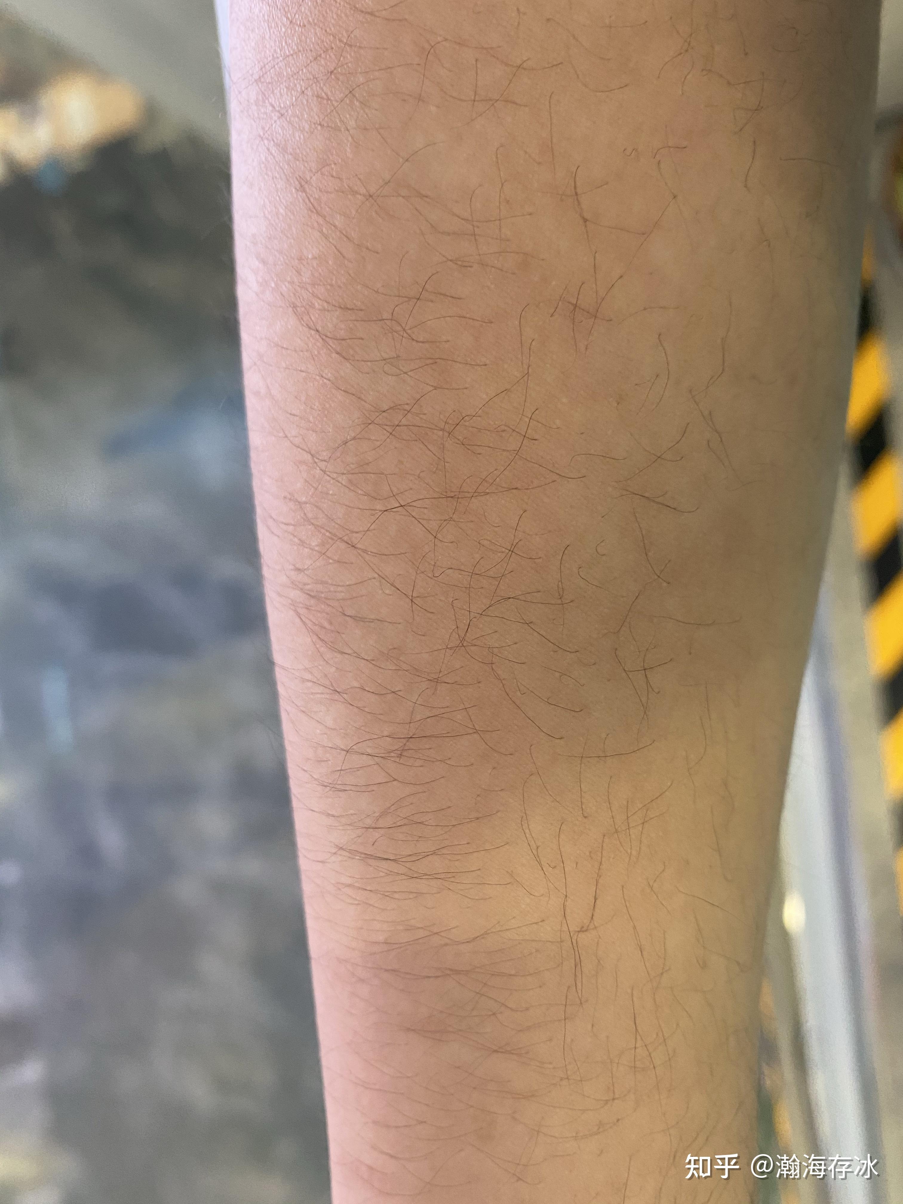 女生长浓密手毛是一种什么样的体验