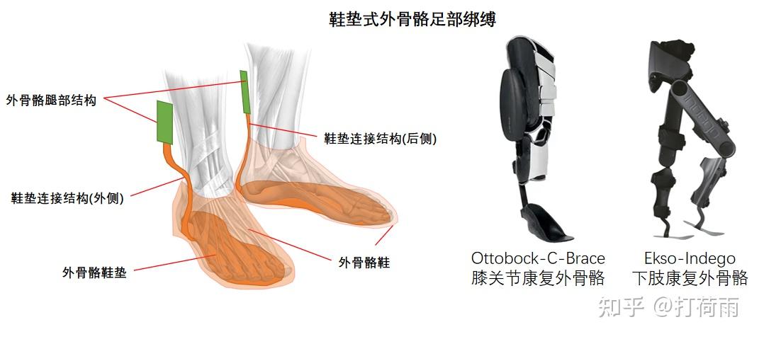 外骨骼绑缚——不可或缺的人机物理接口 - 知乎