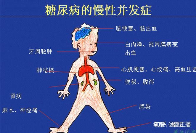 血糖高会引发哪些症状?